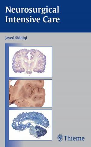 Cover of the book Neurosurgical Intensive Care by John A. McCurdy, Samuel M. Lam