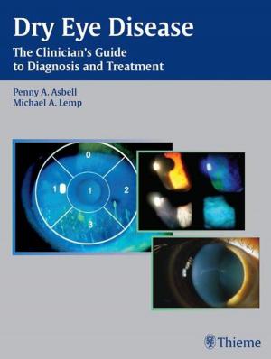 Cover of the book Dry Eye Disease by Myles L. Pensak