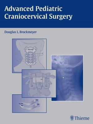 Cover of the book Advanced Pediatric Craniocervical Surgery by A. Leland Albright, Ian F. Pollack, P. David Adelson