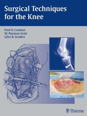 Cover of the book Surgical Techniques for the Knee by Gisela Meier, Johannes Buettner
