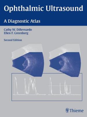 Cover of the book Ophthalmic Ultrasound by Beverly Hashimoto