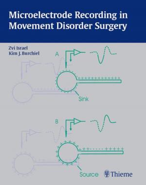 Cover of the book Microelectrode Recording in Movement Disorder Surgery by Dariush Nikkhah