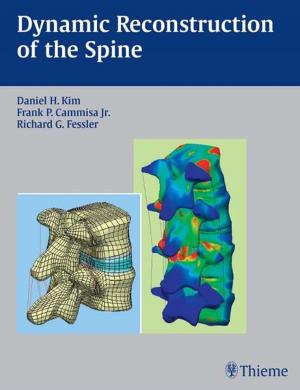 Cover of the book Dynamic Reconstruction of the Spine by R. Bartl, C. Bartl, M. Gewecke