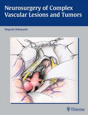 Cover of the book Neurosurgery of Complex Vascular Lesions and Tumors by Claus C. Schnorrenberger, Beate Schnorrenberger