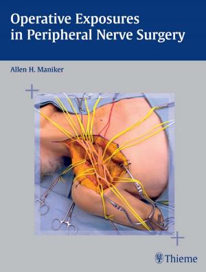 Cover of the book Operative Exposures in Peripheral Nerve Surgery by Peter Fischer