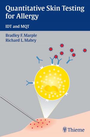 Cover of the book Quantitative Skin Testing for Allergy by 
