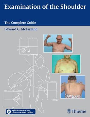 Cover of the book Examination of the Shoulder by Jrgen Freyschmidt, Joachim Brossmann
