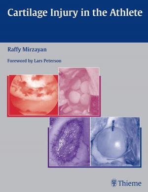 Cover of the book Cartilage Injury in the Athlete by Beverly Hashimoto