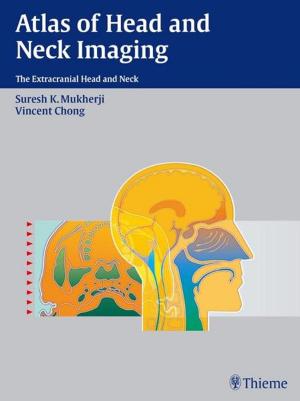 bigCover of the book Atlas of Head and Neck Imaging by 