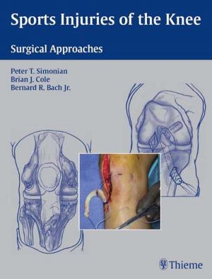 Cover of the book Sports Injuries of the Knee by Christoph Wald, George W. Eastman