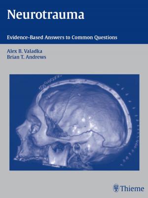 Cover of the book Neurotrauma by Joerg Jerosch, William H. M. Castro