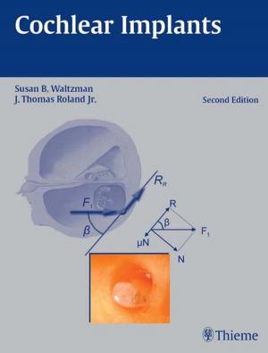 Cover of the book Cochlear Implants by 