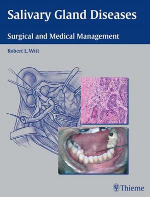 Cover of the book Salivary Gland Diseases by MD JD Levy