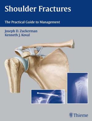 Cover of the book Shoulder Fractures by Claus C. Schnorrenberger, Beate Schnorrenberger