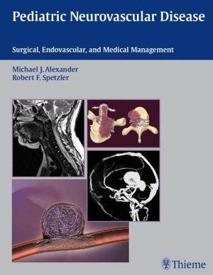 Cover of the book Pediatric Neurovascular Disease by Tim Meyer, Ian Beasley, Zoran Bahtijarevic