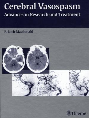 Cover of the book Cerebral Vasospasm by 