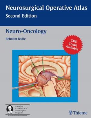 Cover of the book Neuro-Oncology by Anne M Gilroy, Brian R MacPherson, Michael Schuenke