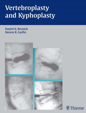 Cover of the book Vertebroplasty and Kyphoplasty by Mahmut Gazi Yasargil
