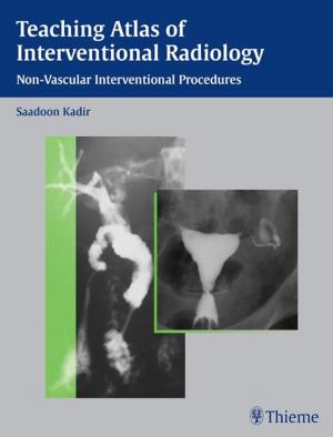 Cover of the book Teaching Atlas of Interventional Radiology by Guenter Schmidt, Lucas Greiner, Dieter Nuernberg