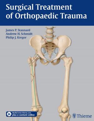 Cover of the book Surgical Treatment of Orthopaedic Trauma by Thomas Stoll