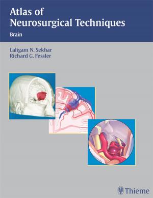 Cover of the book Atlas of Neurosurgical Techniques by Sylvia H. Heywang-Koebrunner, Ingrid Schreer, Susan Barter