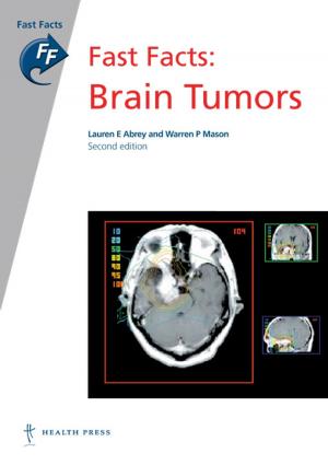 Book cover of Fast Facts: Brain Tumors