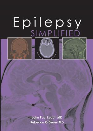 Book cover of Epilepsy Simplified