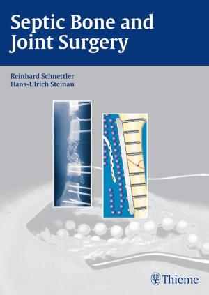Cover of the book Septic Bone and Joint Surgery by A. Leland Albright, Ian F. Pollack, P. David Adelson