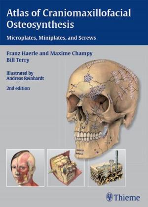 Cover of the book Atlas of Craniomaxillofacial Osteosynthesis by Michael Valente, L. Maureen Valente