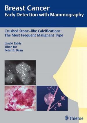 Cover of the book Breast Cancer: Early Detection with Mammography by Wolfgang T. Koos, Robert F. Spetzler, Johannes Lang