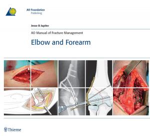 Cover of the book AO Manual of Fracture Management: Elbow & Forearm by Jose Manuel Valdueza, Stephan Schreiber, Jens-Eric Rohl