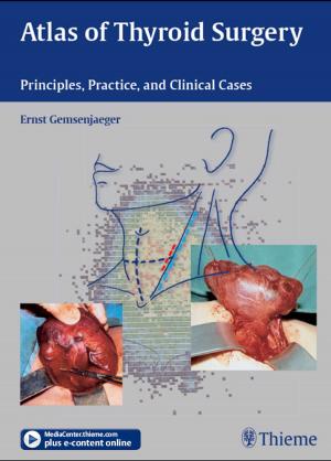 Cover of the book Atlas of Thyroid Surgery by Emil Reif, Torsten Bert Moeller