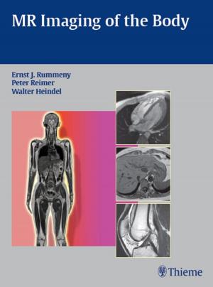 Cover of the book MR Imaging of the Body by Todd J. Albert, Alexander R. Vaccaro
