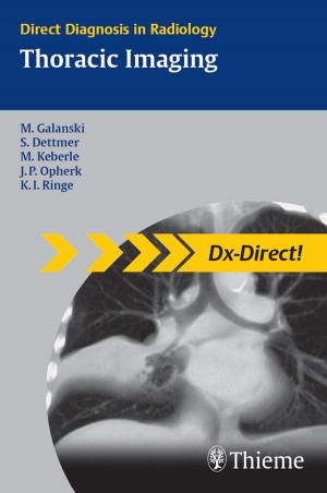Cover of the book Thoracic Imaging by Michael Schuenke, Erik Schulte, Udo Schumacher