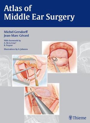 Cover of the book Atlas of Middle Ear Surgery by Tibor Tot, Laszlo Tabar, Peter B. Dean