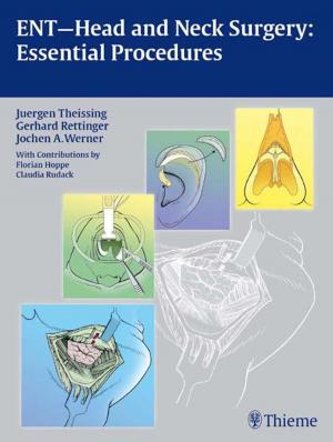 Cover of the book ENT-Head and Neck Surgery: Essential Procedures by Todd J. Albert, Alexander R. Vaccaro