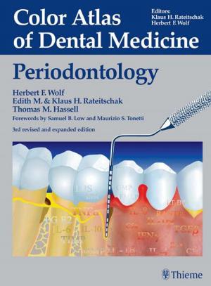 Cover of the book Color Atlas of Dental Medicine: Periodontology by Thomas Rakosi, Thomas M. Graber