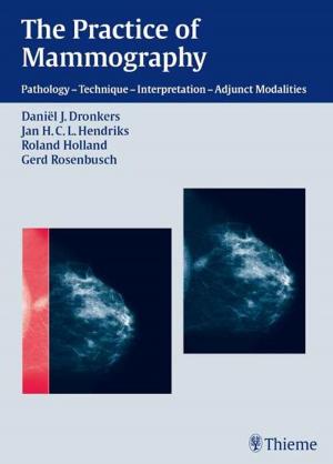 Cover of the book The Practice of Mammography by Jan Ekstrand, Markus Walden, Peter Ueblacker