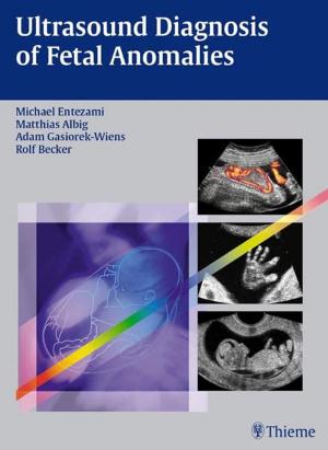 Cover of the book Ultrasound Diagnosis of Fetal Anomalies by E. Albert Reece, Robert L. Barbieri