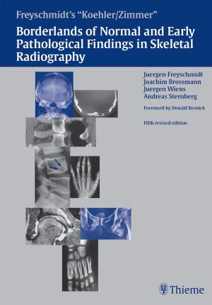 Cover of Koehler/Zimmer's Borderlands of Normal and Early Pathological Findings in Skeletal Radiography