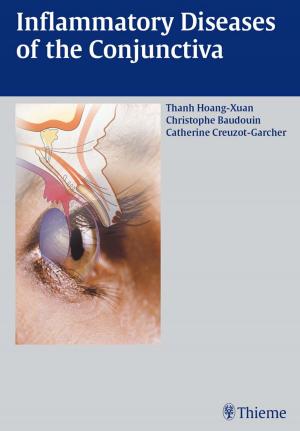 Cover of the book Inflammatory Diseases of the Conjunctivae by Michael Schuenke, Erik Schulte, Udo Schumacher