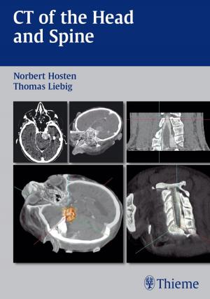 Cover of the book CT of the Head and Spine by Werner Goetz Hosemann, R. K. Weber