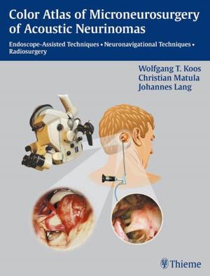 Cover of the book Color Atlas of Microneurosurgery of Acoustic Neurinomas by Fritz Barton