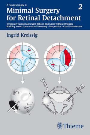 bigCover of the book Practical Guide to Minimal Surgery for Retinal Detachment, Volume II by 
