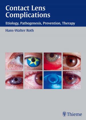 Book cover of Contact Lens Complications