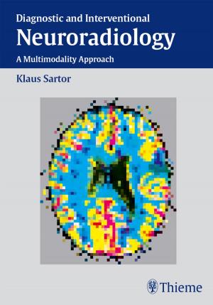 Cover of the book Diagnostic and Interventional Neuroradiology by Nikolaus A. Haas, Ulrich Kleideiter