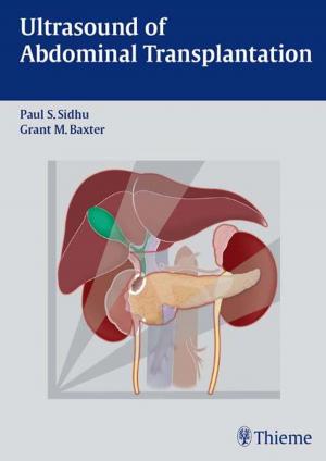 Cover of the book Ultrasound of Abdominal Transplantation by Robert F. Spetzler, Wolfgang T. Koos, B. Richling