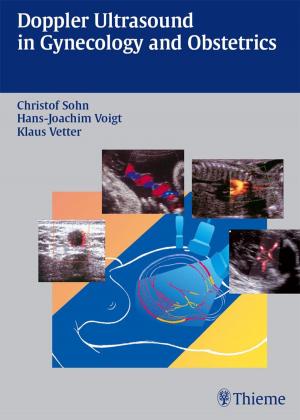 Book cover of Doppler Ultrasound in Gynecology and Obstetrics