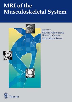 Cover of the book MRI of the Musculoskeletal System by Axel Rubach