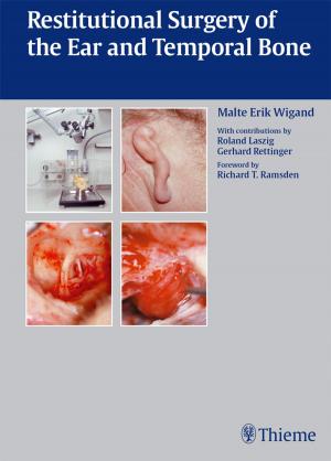 Cover of the book Restitutional Surgery of the Ear and Temporal Bone by Hildegard Wittlinger, Dieter Wittlinger, Andreas Wittlinger